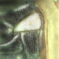 Mesepimeron de Cycloneda sp.